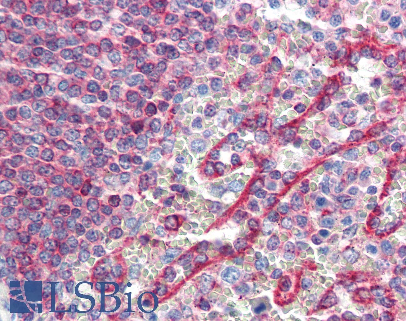 IHC-plus™ Monoclonal Mouse anti-Human HLA-E Antibody (clone MEM-E/02, IHC, WB)