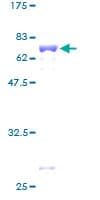 Human MRPS22 Protein (Recombinant GST)
