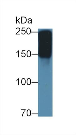 A2M / Alpha-2-Macroglobulin Antibody (aa157-389, PE)