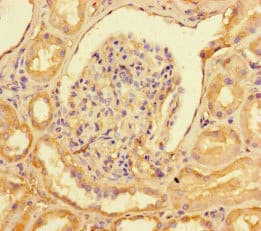 COUP-TFII / NR2F2 Antibody