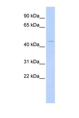 HTR4 / 5-HT4 Receptor Antibody (aa144-193)