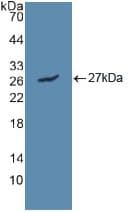 LIPC / Hepatic Lipase Antibody (aa25-247)