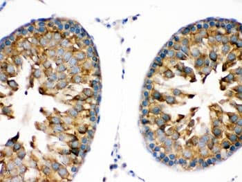 TRPM5 Antibody