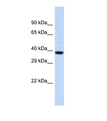 Polyclonal Rabbit anti-Human NOX4 Antibody (aa165-214, WB)