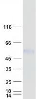 Human POMK / SGK196 Protein (Recombinant Myc-DDK (Flag))