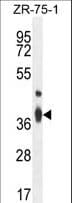 TMBIM4 / GAAP Antibody (aa1-30)