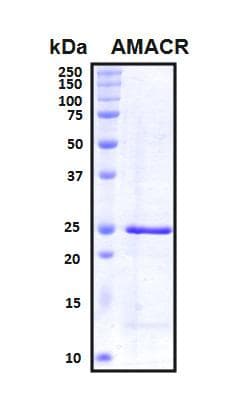 Human AMACR / P504S Protein (Recombinant His, N-Terminal)
