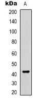 Polyclonal Rabbit anti-Human ARR3 / Cone Arrestin Antibody (C-Terminus, IHC, IF, WB)