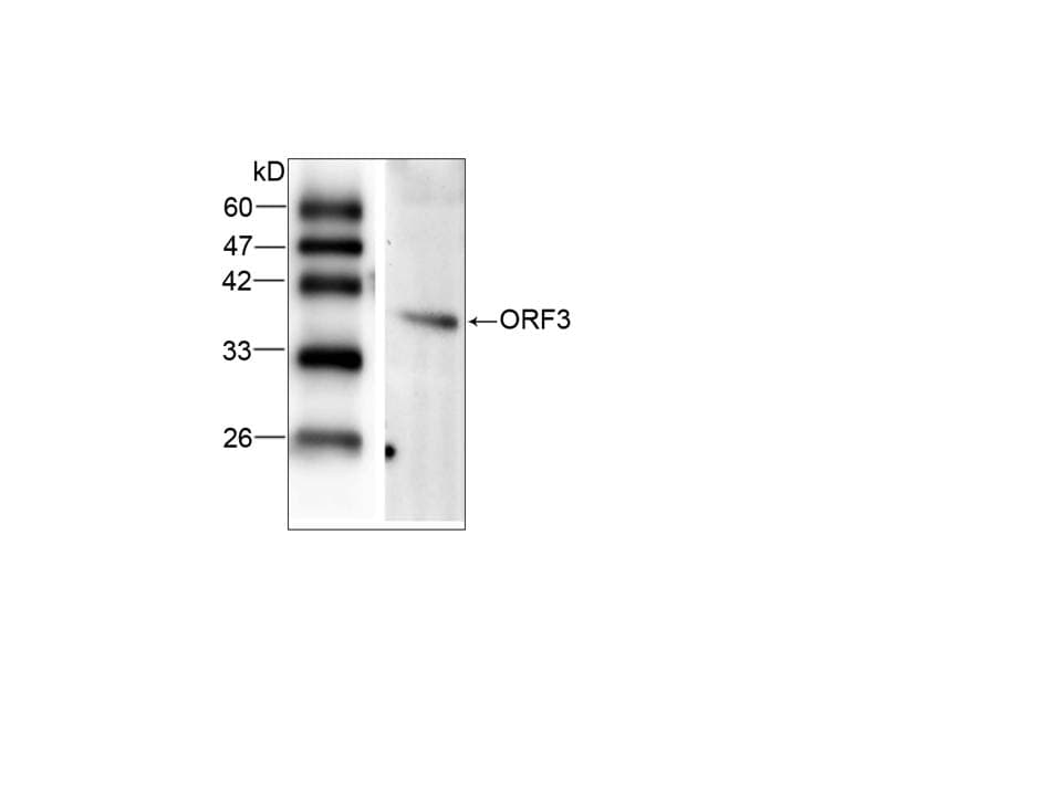 Monoclonal Mouse anti-Hepatitis E Virus HEV / Hepatitis E Virus Antibody (clone BU-33, aa34-123, WB)
