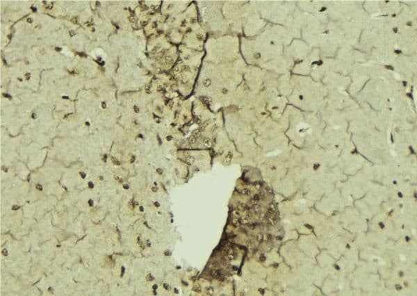SRSF1 / SF2 Antibody