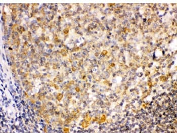 Polyclonal Rabbit anti-Human TRIB2 Antibody (IHC, WB)
