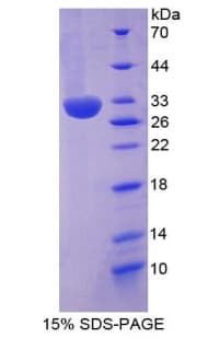 Human ITIH2 Protein (Recombinant His-T7)