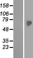 TKTL2 Protein (Over-Expression Lysate Myc-DDK (Flag))