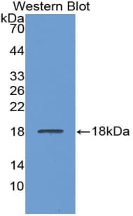 LCAT Antibody (aa290-433)