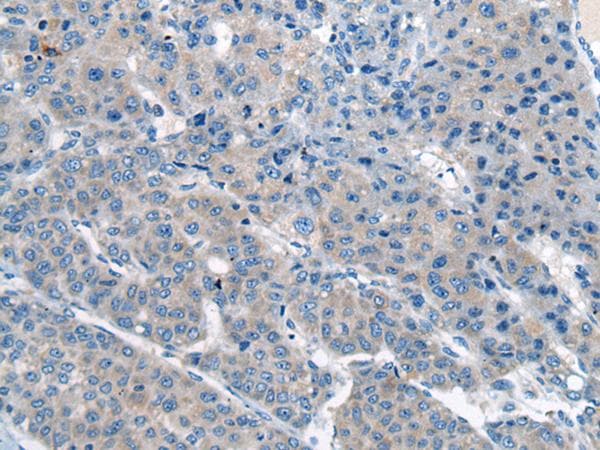 CITED4 Antibody