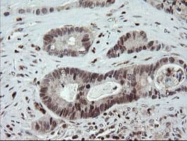 FAM164A / CGI-62 Antibody (clone OTI4G2, Carrier-free)
