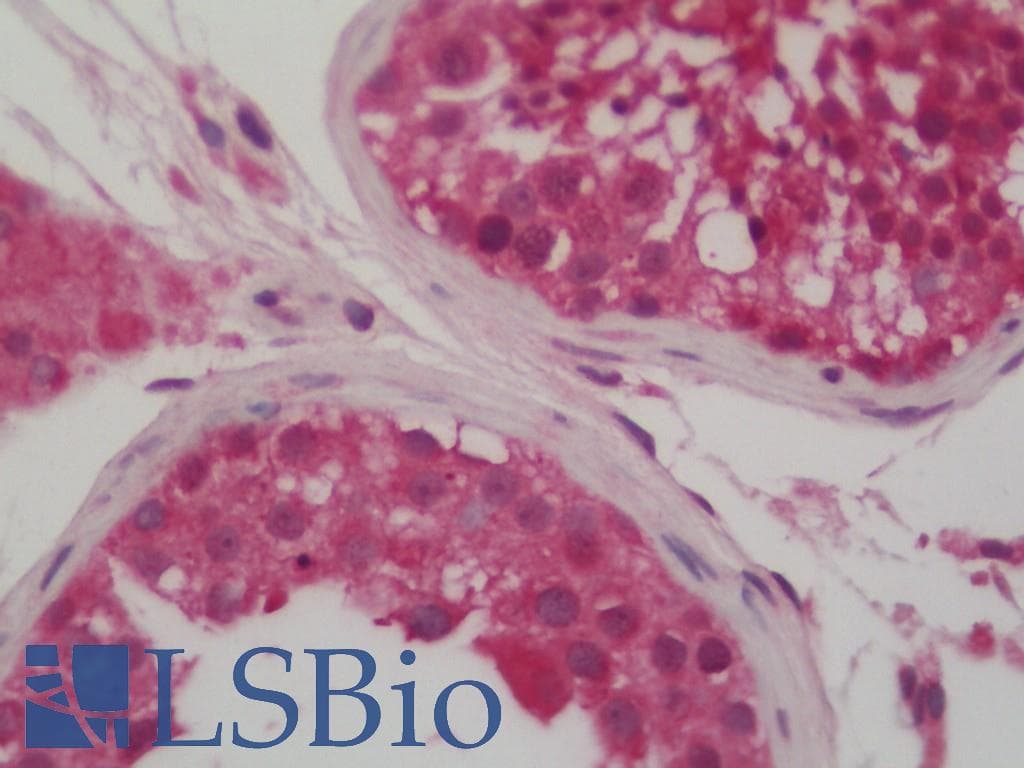 IHC-plus™ TCEB1 / Elongin C Antibody