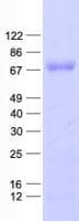 Human TRXR1 / TXNRD1 Protein (Recombinant His, N-Terminal)
