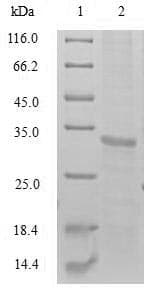 Human PRSS21 / Testisin Protein (Recombinant 10His, N-terminus + Myc, C-terminus)