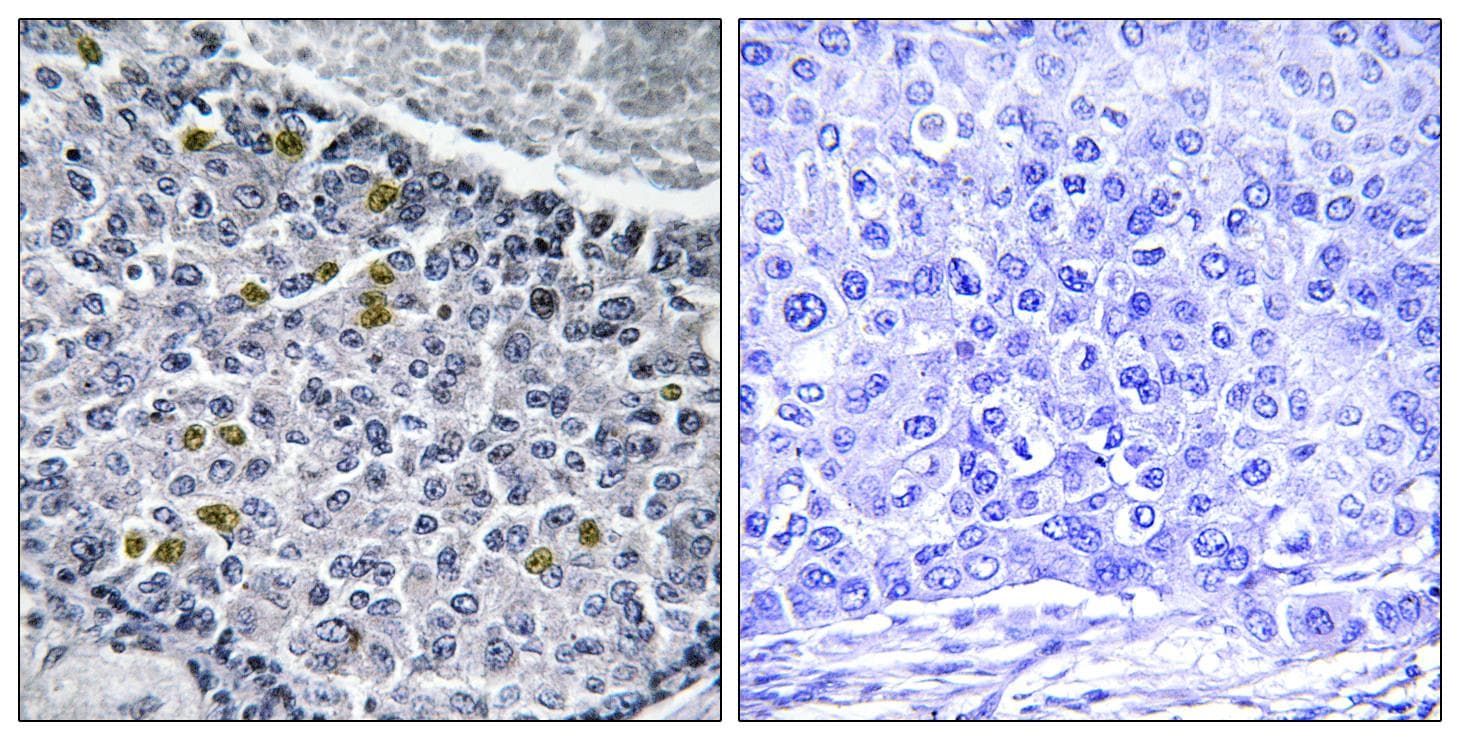 MAD1L1 / MAD1 Antibody (phospho-Ser428)