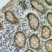 Polyclonal Rabbit anti-Human AGAP2 / PIKE Antibody (IHC, WB)