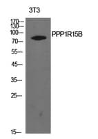 PPP1R15B Antibody