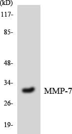 IHC-plus™ MMP7 / Matrilysin Antibody (aa198-247)