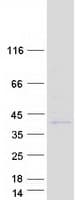 Human PRSS42 Protein (Recombinant Myc-DDK (Flag))