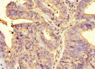 FAM65B / DIFF48 Antibody
