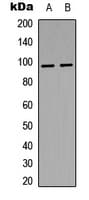 INSR / Insulin Receptor Antibody (phospho-Tyr1361)