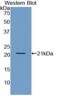 ARPC4 Antibody (aa3-165)