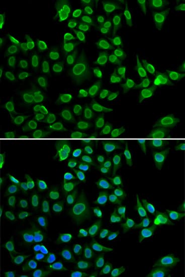 LAMB2 / Laminin Beta 2 Antibody