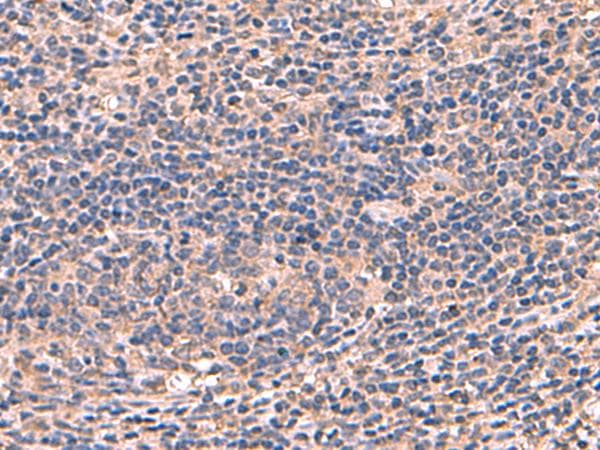 AHCYL1 / DCAL Antibody