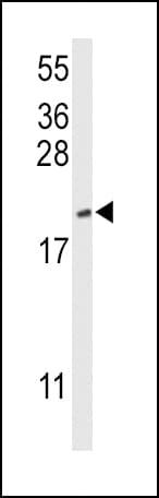 Polyclonal Rabbit anti-Human CFL1 / Cofilin Antibody (aa70-98, WB)