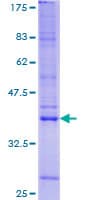 Human TRIP / LRRFIP1 Protein (Recombinant GST)