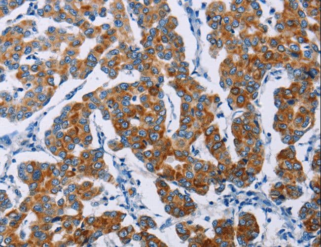 Polyclonal Rabbit anti-Human NKP30 Antibody (IHC)