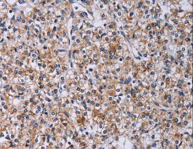 CA4 / Carbonic Anhydrase IV Antibody