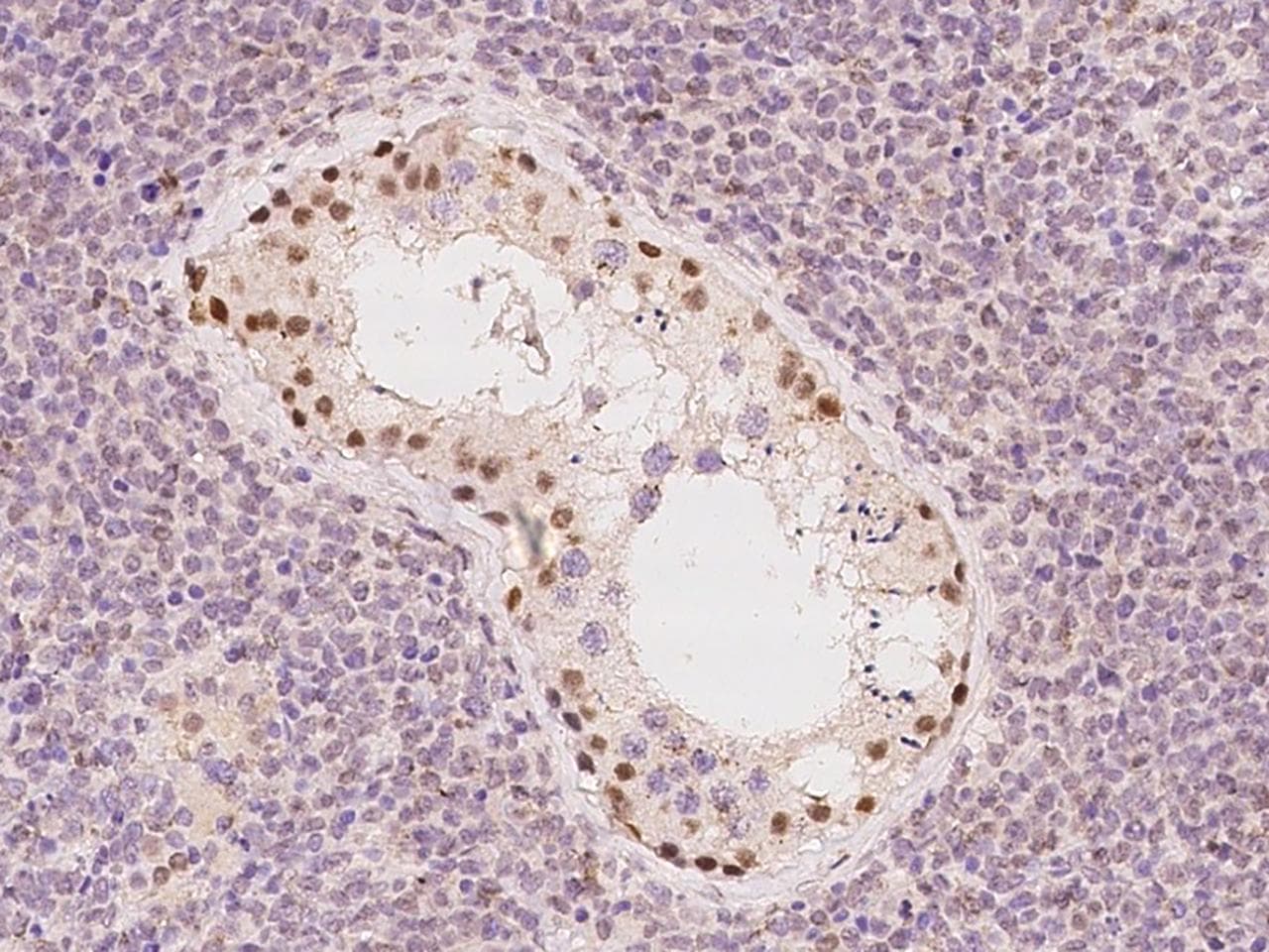 ZNF516 Antibody