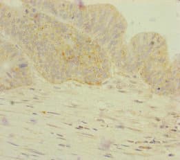 Polyclonal Rabbit anti-Human GORASP2 / GRASP55 Antibody (IHC)