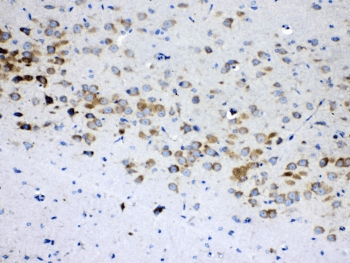 RPS6 / Ribosomal Protein S6 Antibody