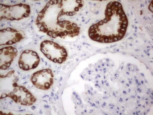 Acidic Cytokeratin Antibody (clone 3E10)