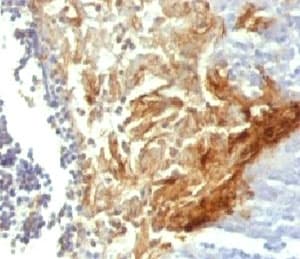 IVL / Involucrin Antibody (clone INVO49)