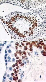 Monoclonal Rat anti-Mouse CCR6 Antibody (clone 18B9E6, Azide-free, IHC, WB)