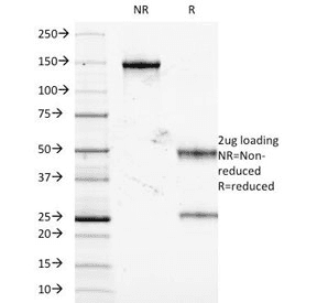 TNF Alpha Antibody (clone J2D10)