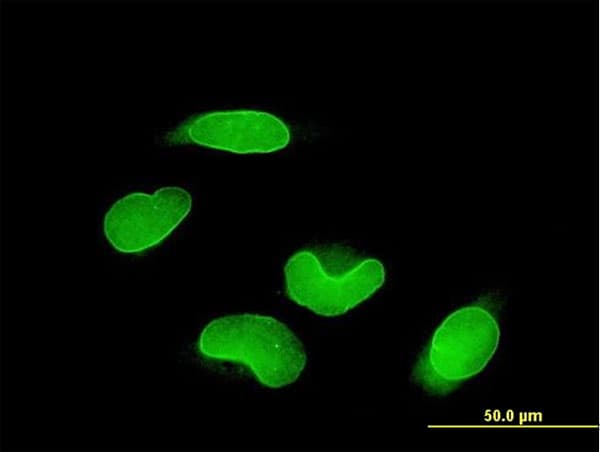 RUNX1T1 / ETO Antibody (clone 5A12)