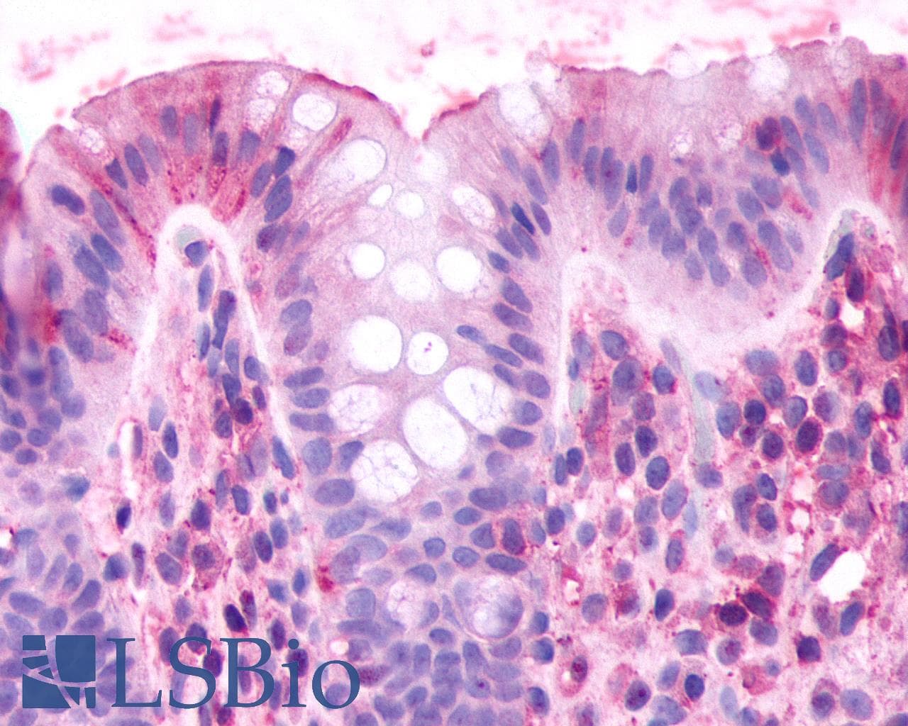 PathPlus™ CELSR2 Antibody (N-Terminus)