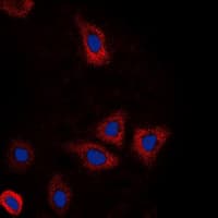DDX3 / DDX3X Antibody (Internal)