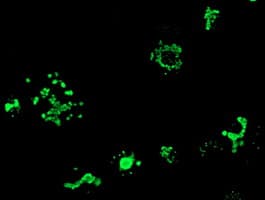 IHC-plus™ MYD88 Antibody (clone 1B4)