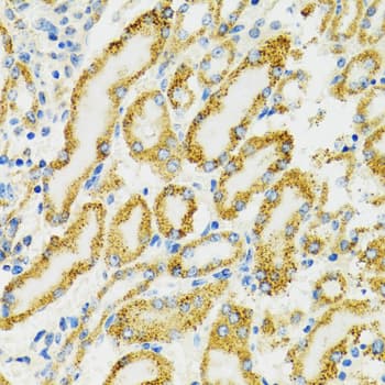 Polyclonal Rabbit anti-Human HSPA9 / Mortalin / GRP75 Antibody (IHC, IF, WB)