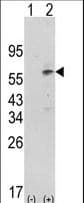 PDK1 Antibody (aa1-30)
